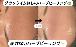 NHerb【エヌハーブ】所属・横田 汐里のエステ・リラクイメージ