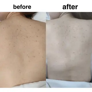 麻布十番エステサロン WhiteAzabuのエステ・リラクイメージ