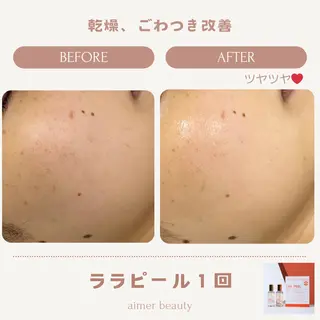 aimer beautyのエステ・リラクイメージ