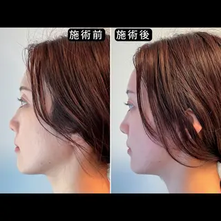 渋谷 小顔美容鍼 専門サロン YZのエステ・リラクイメージ