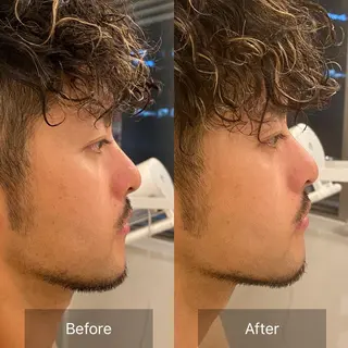 メンズ エステティックサロンPartagé【パルタージュ】所属・小尻・太もも痩せる パルタージュのエステ・リラクイメージ