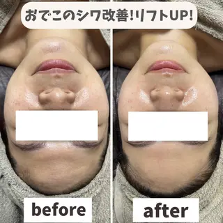 ReN所属・ReN エステサロンのエステ・リラクイメージ