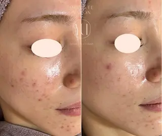 1ヶ月後も半分残る 高持続LEDエクステのマツエク・マツパデザイン