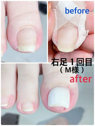 ネイル 柴崎 美幸のネイルデザイン