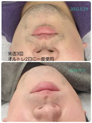 VINOS高岡所属・宮野 千春【ビノス高岡】のエステ・リラクイメージ