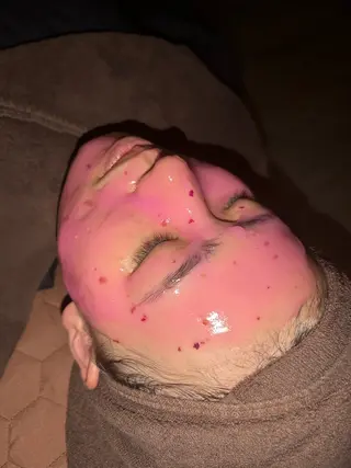 肌質改善・小顔サロン 20代店長RINNAのエステ・リラクイメージ