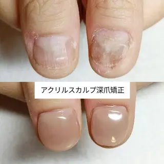 パーマ 深爪矯正/爪育成ケア manie nailのネイルデザイン