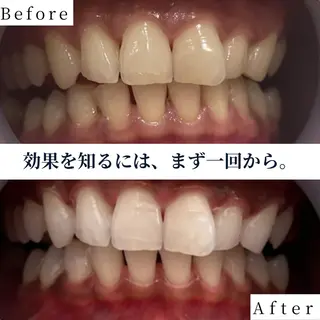 ホワイトニング ショップ南堀江のその他イメージ