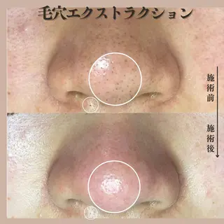 Muqu.所属・Muqu. 毛穴サロンのエステ・リラクイメージ