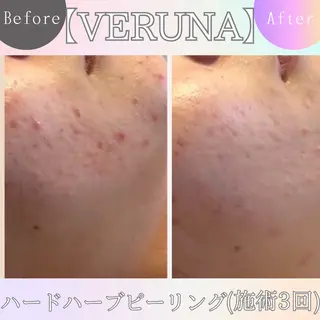 ニキビ改善専門店 d'Albaのエステ・リラクイメージ