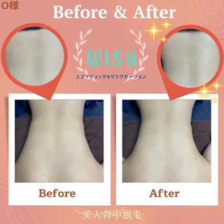 WISH 美肌脱毛のプロ！須藤のエステ・リラクイメージ