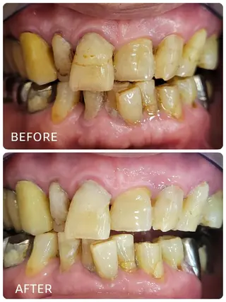 ホワイトニングサロン ラウレアのその他イメージ