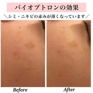 Bellesthe （ベルエステ）のエステ・リラクイメージ