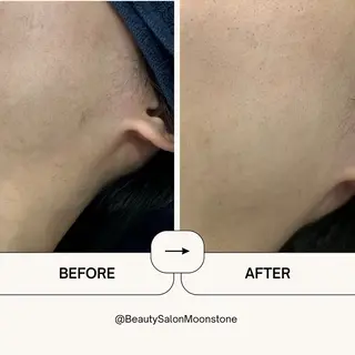 メンズ Beauty Salon Moonstone所属・Moonstone 男女•キッズ脱毛のエステ・リラクイメージ