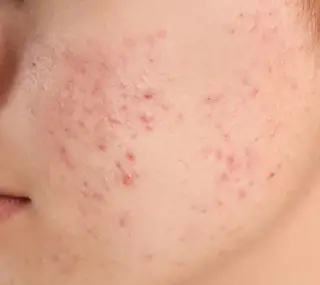 🅖🅤🅩🅔🅛 salonのエステ・リラクイメージ