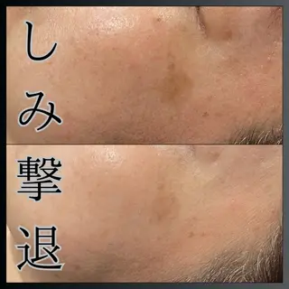 LiZA エステティックサロンのその他イメージ