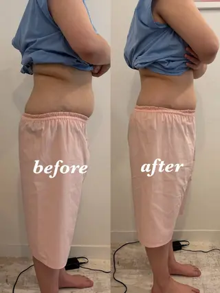 腸活サポート みなみののエステ・リラクイメージ