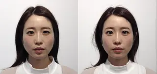 美容整体　小顔矯正 プラスフィール 大浜のエステ・リラクイメージ