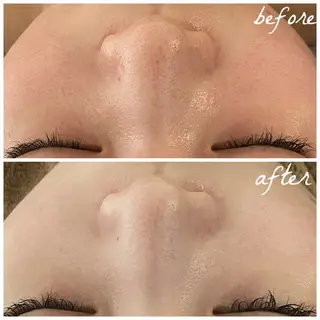 メンズ メナード岐阜市茜部 杉浦のエステ・リラクイメージ