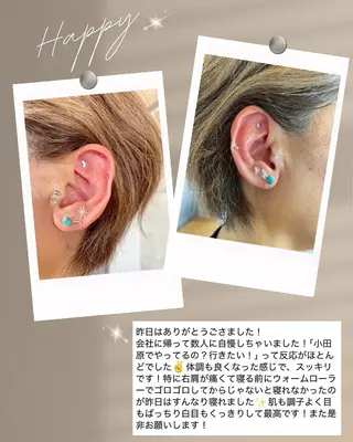 mimine エメラルド式耳つぼのその他イメージ