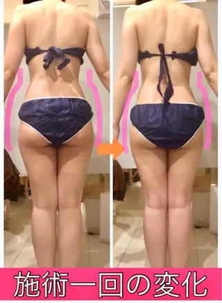 ロング カラー パーマ ヘアアレンジ メンズ キッズ ネイル マツエク・マツパ ‍痩身＆ボディ 結果出し🌟丹野のエステ・リラクイメージ