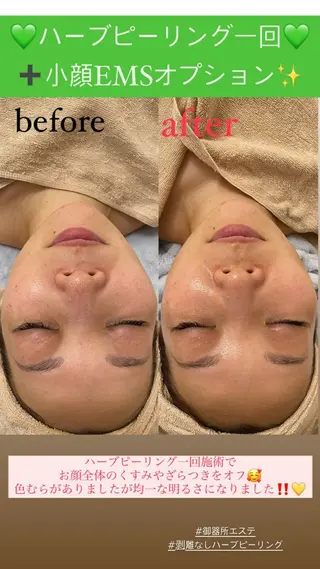 メンズ Salon de Lino 御器所のエステ・リラクイメージ