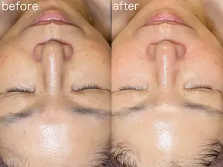 医療提携Beauty SalonMuseのエステ・リラクイメージ