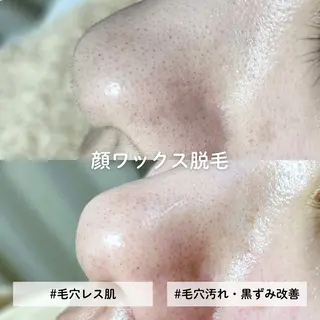 EST BEAUTY所属・顔ワックス脱毛/ ハーブピーリングのエステ・リラクイメージ