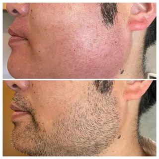 メンズ WAX＆光脱毛/瘦身 アイブロウ/牧野亞紀の眉毛・アイブロウイメージ