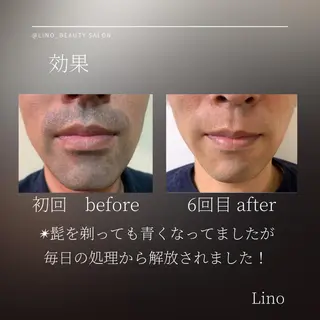 メンズ Lino 《リノ》のエステ・リラクイメージ