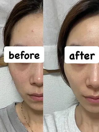 デ・アイム京橋所属・長谷川 華音のエステ・リラクイメージ