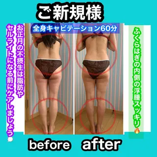 痩身/脱毛/ネイル HARUKAのエステ・リラクイメージ