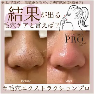 Eyelash salon MORE(モア)所属・安納 麻穂のエステ・リラクイメージ