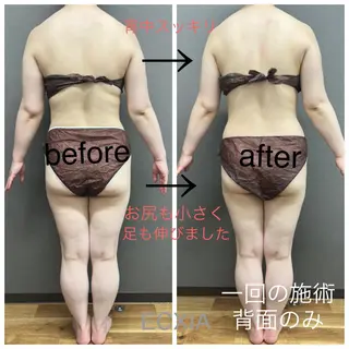 ECXIA 【エクシア】のエステ・リラクイメージ