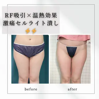 小顔矯正専門店 【RED】池田のエステ・リラクイメージ