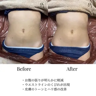 Plus One Beauty所属・【新大阪】痩身/小顔 美肌フェイシャルのエステ・リラクイメージ