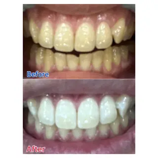 MBEAUTYSALON 千葉店・京成大久保所属・Melty 輝のその他イメージ