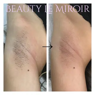 ビューティー ミロワールのエステ・リラクイメージ