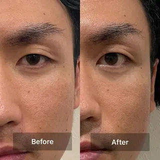 メンズ マツエク・マツパ RUFF.所属・竹廣 春奈のヘアスタイル