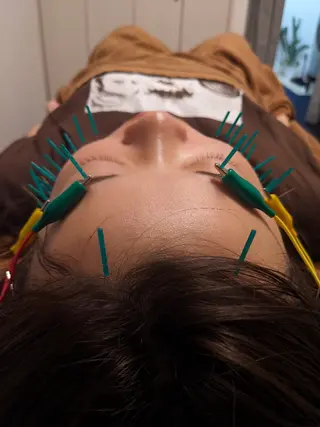 乃々鍼灸・整体院　表参道所属・乃々鍼灸整体院　植木 　【美容鍼/整体】のエステ・リラクイメージ