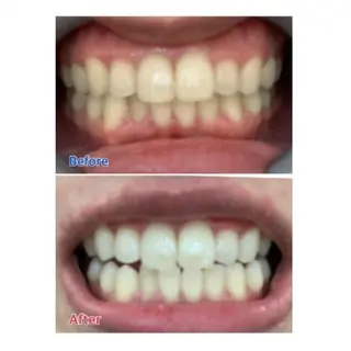 M渋谷店所属・M渋谷 ホワイトニングのエステ・リラクイメージ