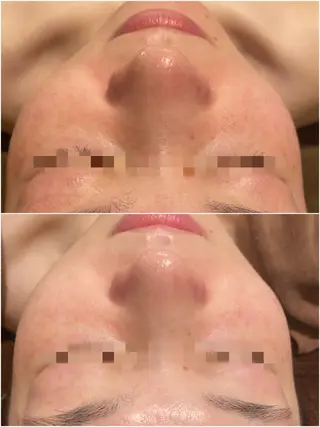 美u•p 鶴ヶ峰店のマツエク・マツパデザイン