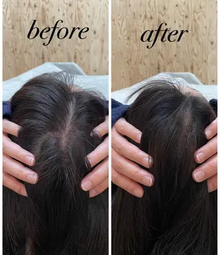 ate'所属・個室ドライヘッドスパ 🍃moriのエステ・リラクイメージ