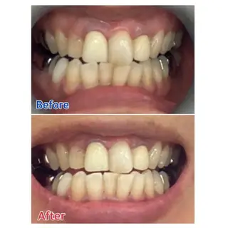 M渋谷店所属・M渋谷 ホワイトニングのエステ・リラクイメージ