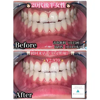 ホワイトニングビューティー西宮店所属・ホワイトニングビュー ティー西宮店のその他イメージ