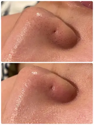 【リベルハーブピーリング認定店】敏感肌・美白脱毛専門店Dione立川店所属・Dione 立川店のエステ・リラクイメージ