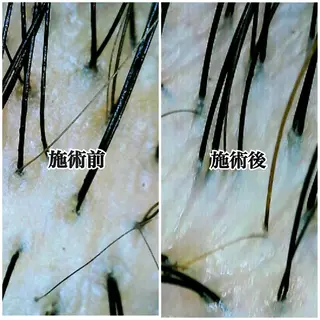 🛁仙台/ヘッドスパ /中野凜香🛁のヘアスタイル