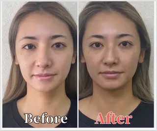 整体 LALUZ中目黒のその他イメージ