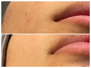 医療提携メンズ脱毛 CDFAkasakaのエステ・リラクイメージ