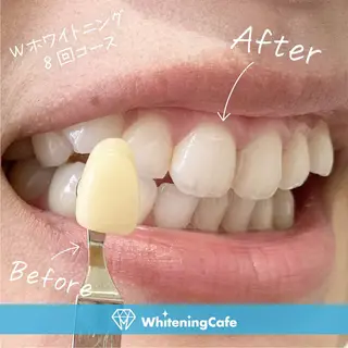 ホワイトニングカフェ神戸元町店所属・ホワイトニングカフェ 神戸元町店のエステ・リラクイメージ